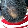 2011-0626-今天用手機拍的頭髮照