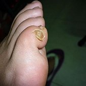 表層萎縮從側邊開始剝落[不要修剪不然根會斷了會有再長的疑慮]