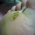 從旁邊有看到剝落的現象...不可以修剪..或自己幫它拔掉..