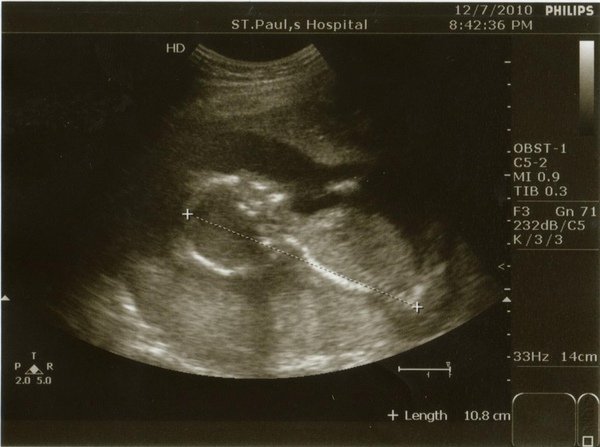 BABY991207-3_copy.jpg