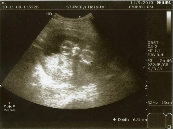 BABY991109-3_copy.jpg