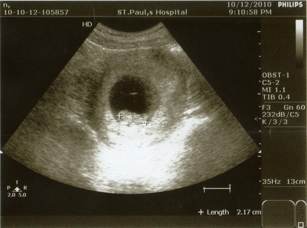 BABY991012-1_copy.jpg