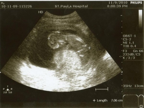 BABY991109-2_copy.jpg