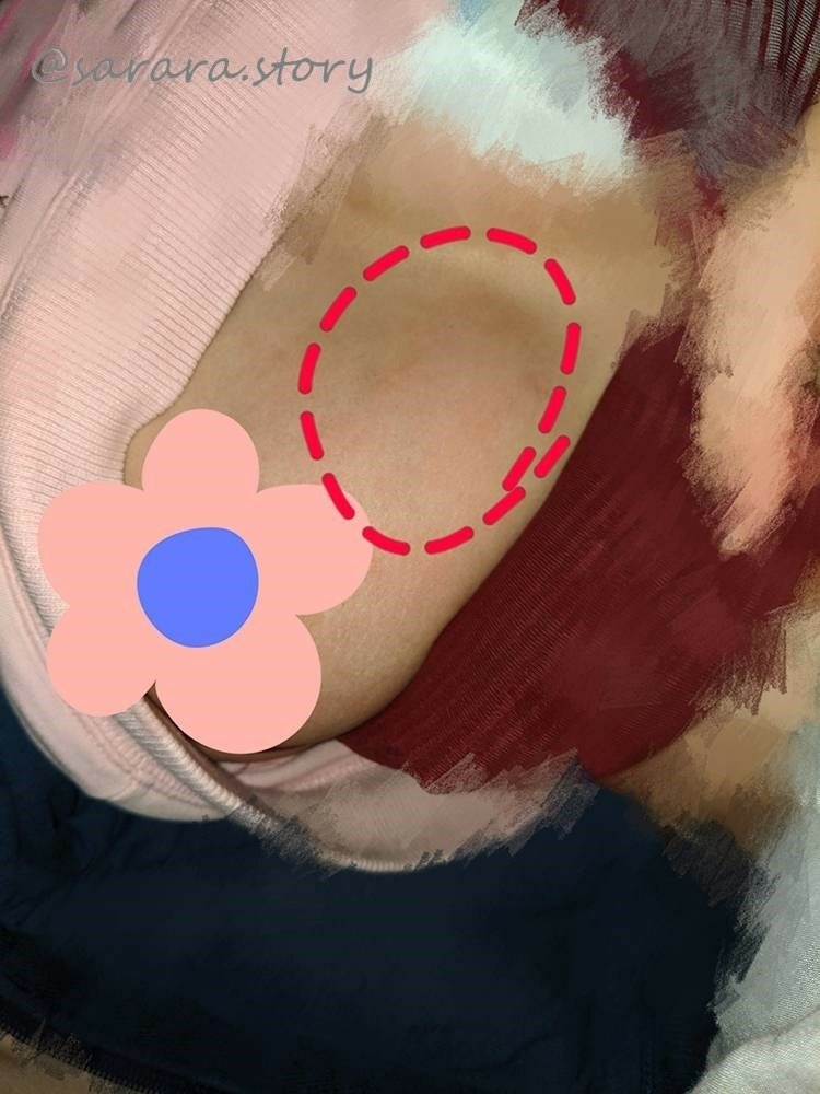 親餵_乳腺炎_@sarara.story.jpg
