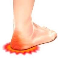 heel-pain-causes