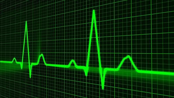 heart-cardiogram