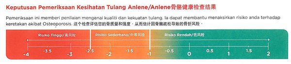 Bone density meter