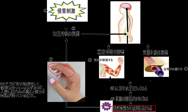 肩手症候群1.gif