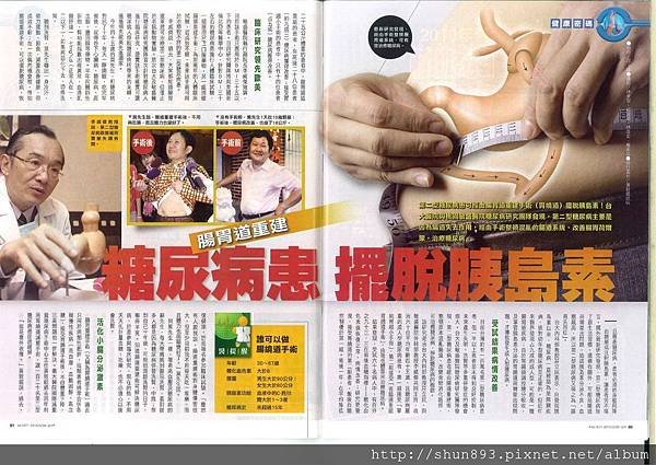 腸胃道重建治療糖尿病