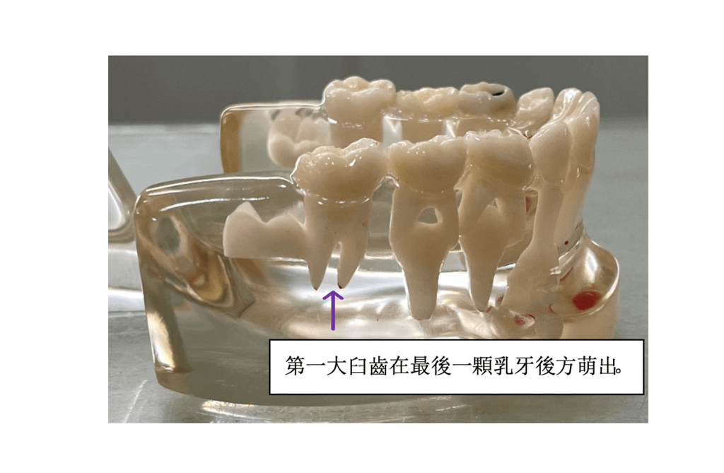 「兒童牙科」小朋友覺得最後方的牙齦腫，怎麼辦?