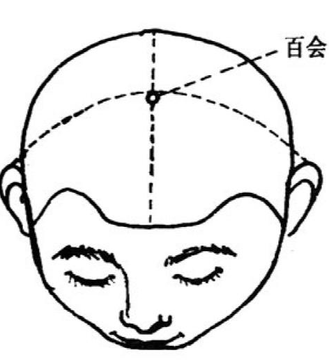 百會