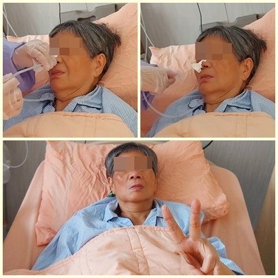 1122 拔鼻胃管.jpg