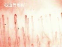 您應該注意的「微循環」.jpg