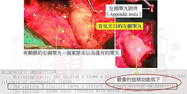 病理--睪丸切片.jpg
