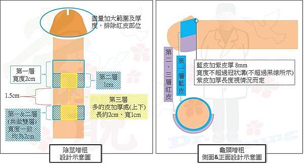 不均衡增粗設計圖.jpg