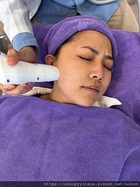 ≡醫美≡愛爾麗診所 HIPRO-S 打造完美臉部輪廓 龍捲風