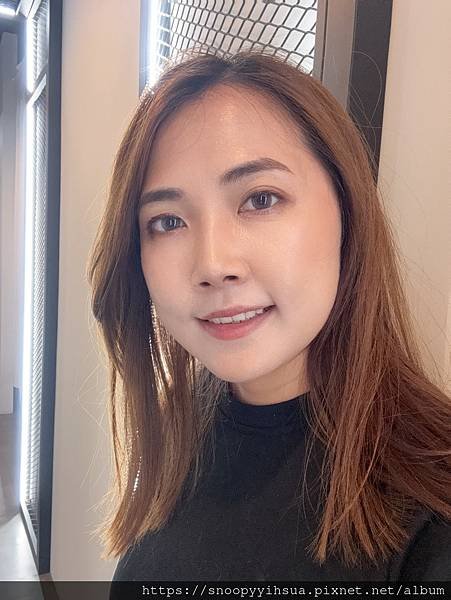 ≡醫美≡愛爾麗診所 HIPRO-S 打造完美臉部輪廓 龍捲風