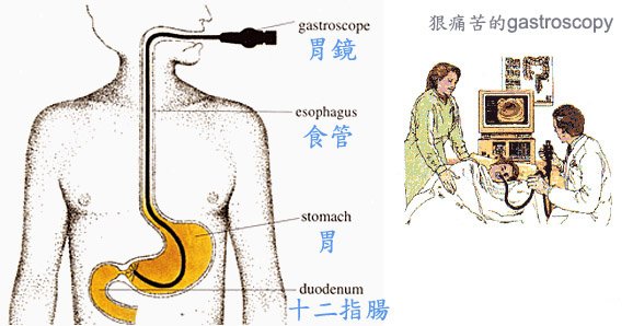 照胃鏡