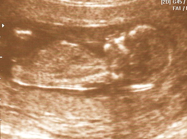 lemon_20081204_1.jpg