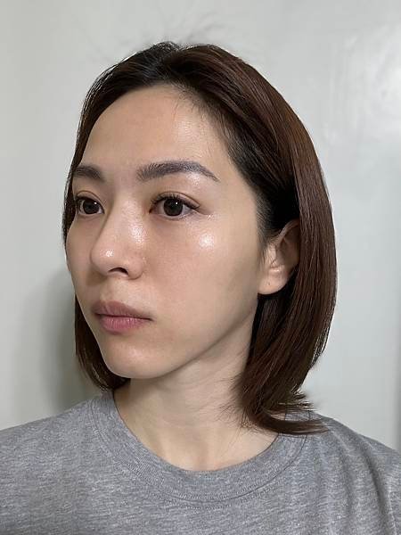 [ 醫美 ]日曦美學診所 {海芙音波 第三代} 即刻擁有拉提