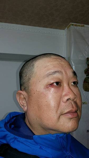 1050221種生根，在高医擠膿包之真實故事.jpg