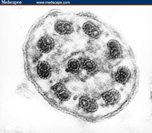 mgm502483_fig.gif