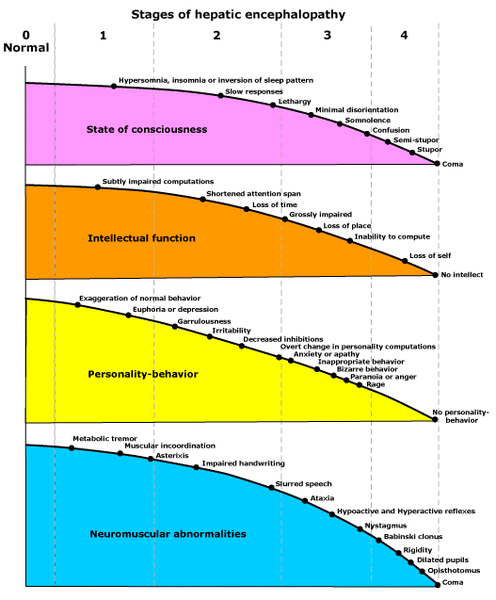 Stages_hep_encephalopathy.gif