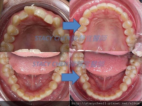 occlusal.jpg