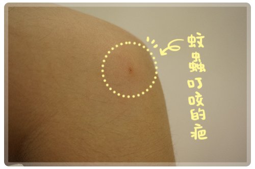 修護凝膠14