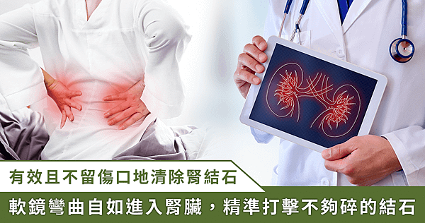 腎結石一次清乾淨！軟式輸尿管鏡搭配「可彎吸石鞘」 有效且不留