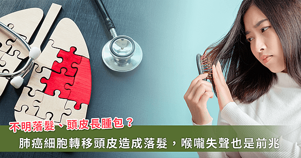 頭皮腫瘤竟與癌症轉移有關！肺部腫瘤也會造成落髮【龜鹿】_龜鹿
