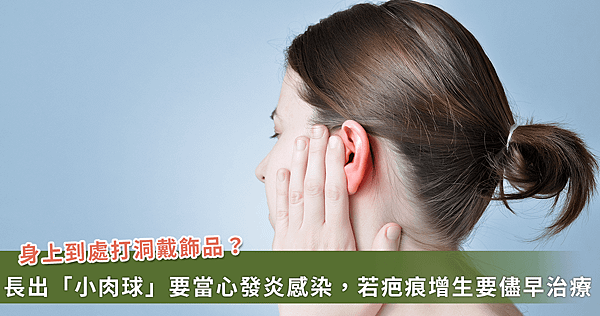 愛美穿耳洞竟長出「小肉瘤」！醫提醒「1」體質不適合【龜鹿】_
