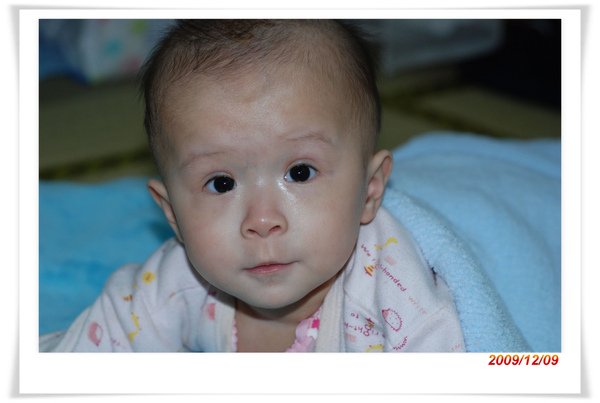20091209_7M7D臉臉好多了.jpg