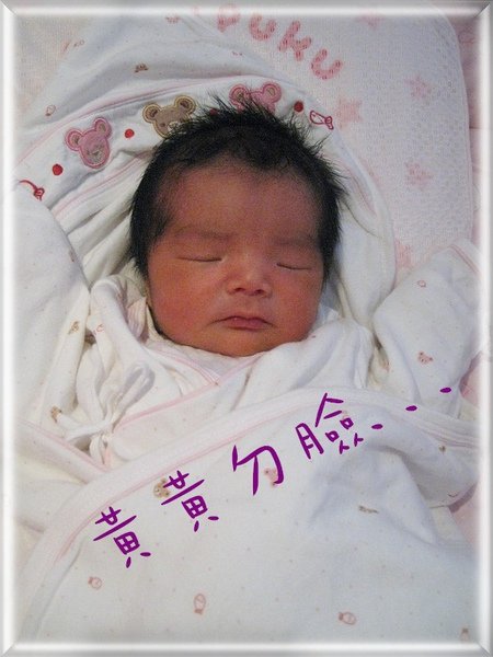 黃膽.jpg