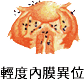 子宮內膜異位症-2.gif