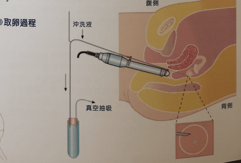 螢幕快照 2018-02-04 上午1.23.06.png