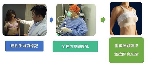 隆乳手術流程2.jpg