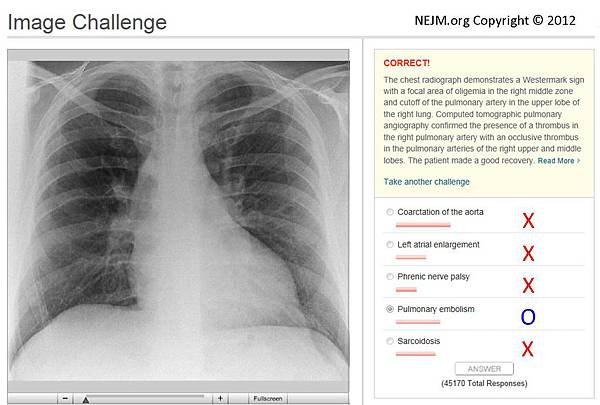 NEJM-02