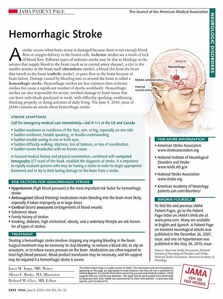 hemorrhagic stroke3