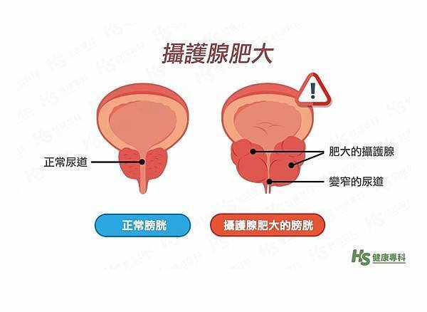 體驗｜專利萃取大豆營養，男性生理機能正常運作、順暢關鍵成分【