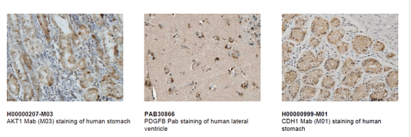 Melanoma-Antibodies abnova.png