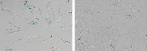 衰老細胞β-半乳糖苷酶染色試劑盒-Aging-Cell-β-galactosidase-Staining-Kit-Servicebio貨號G1073-100T.jpg