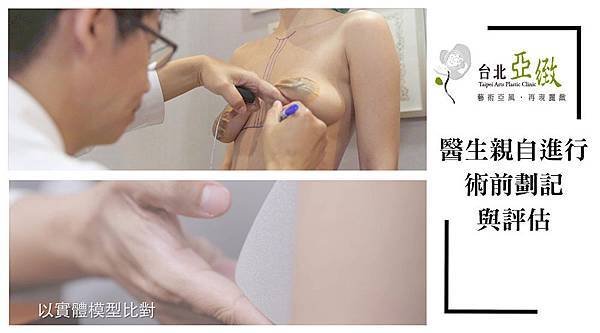 006水滴型果凍矽膠隆乳手術按摩比較差異自然莢膜.jpg