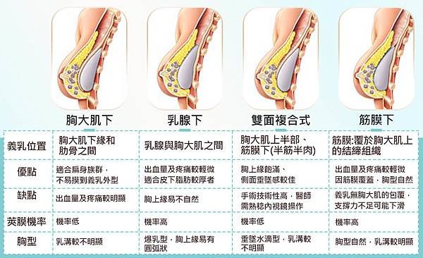 台北亞緻內視鏡果凍隆乳01