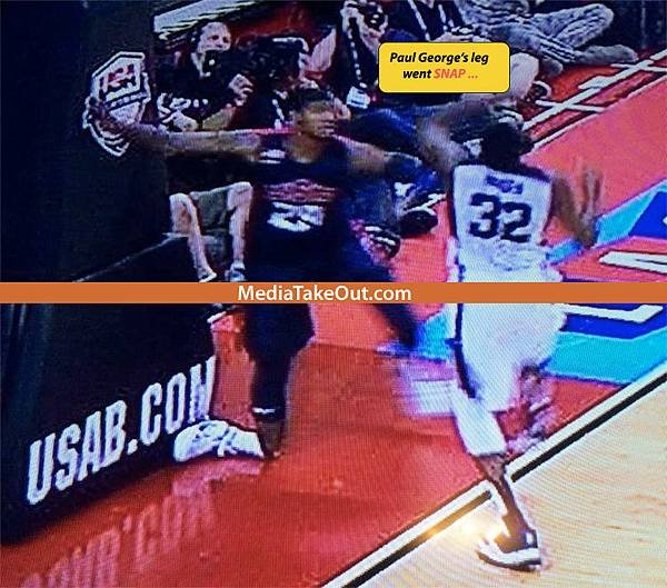 Paul George Leg (2).jpg