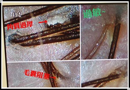 頭皮檢測圖