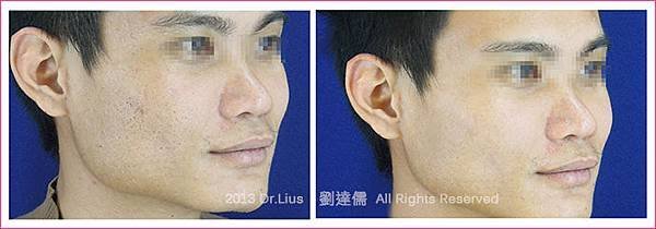 術前術後-3.jpg
