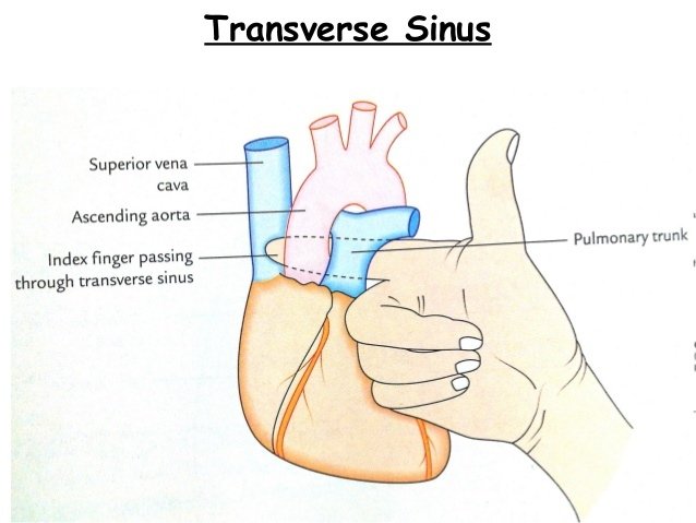 transverse_pericardial_sinus.jpg