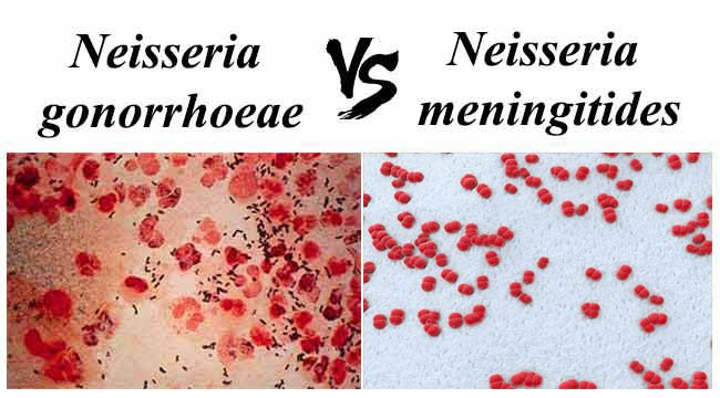 featured-Difference-between-Neisseria-gonorrhoeae-and-Neisseria-meningitides.jpg