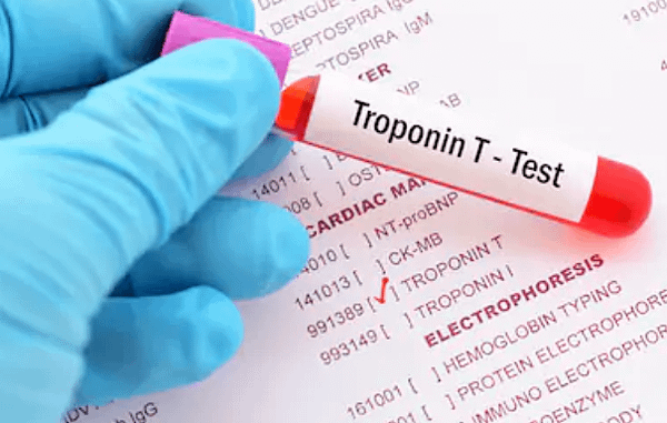 troponin.PNG